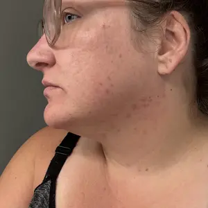 玻璃肌套装图集